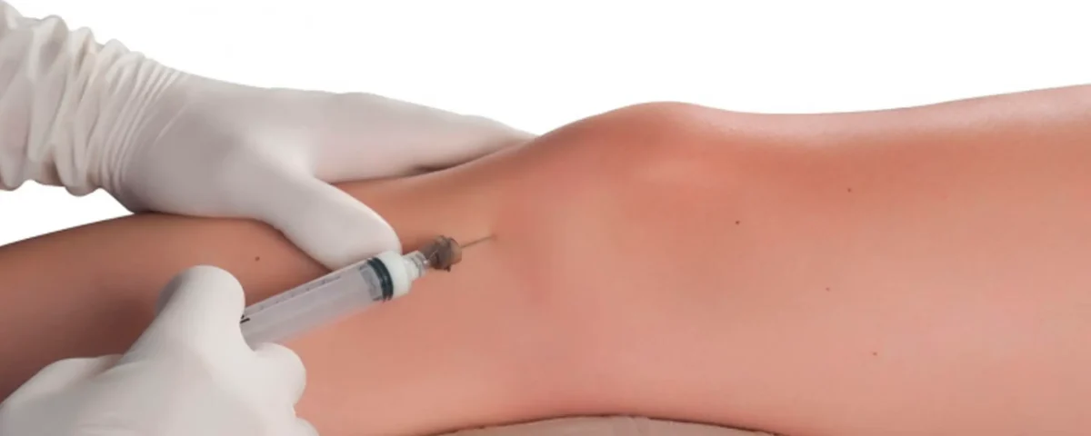 Tratamiento de proloterapia en Santa María Fisiomedic para estimular la recuperación de ligamentos y reducir el dolor articular.