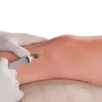 Tratamiento de proloterapia en Santa María Fisiomedic para estimular la recuperación de ligamentos y reducir el dolor articular.