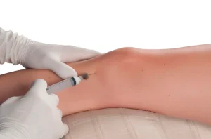 Tratamiento de proloterapia en Santa María Fisiomedic para estimular la recuperación de ligamentos y reducir el dolor articular.