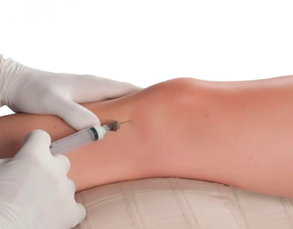 Tratamiento de proloterapia en Santa María Fisiomedic para estimular la recuperación de ligamentos y reducir el dolor articular.