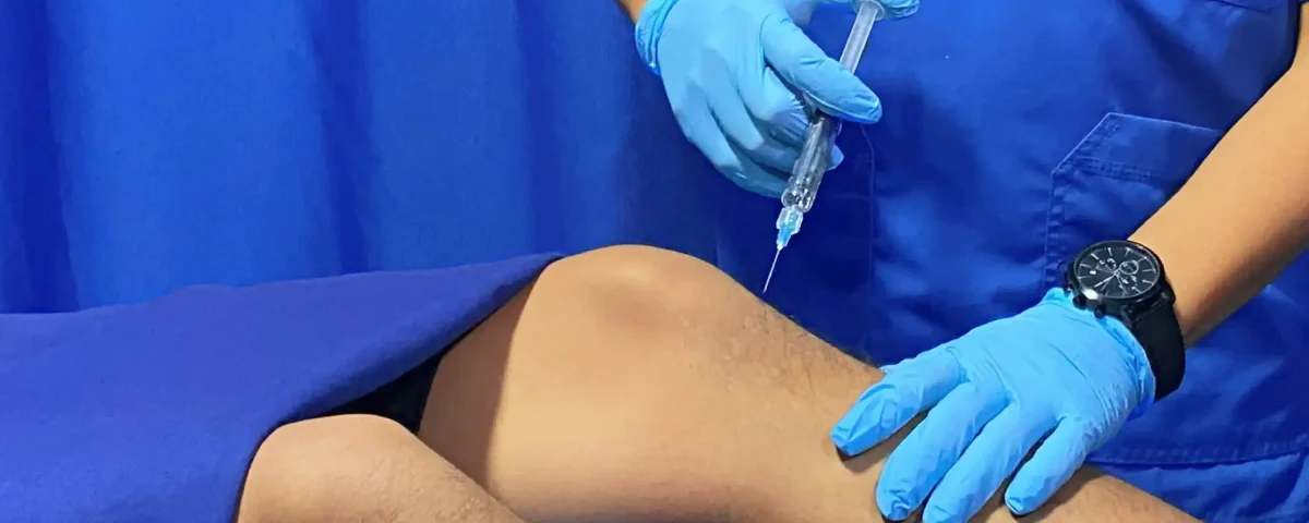 Aplicación de ácido hialurónico en Santa María Fisiomedic como parte del servicio de medicina regenerativa para reducir el dolor articular.
