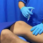 Aplicación de ácido hialurónico en Santa María Fisiomedic como parte del servicio de medicina regenerativa para reducir el dolor articular.