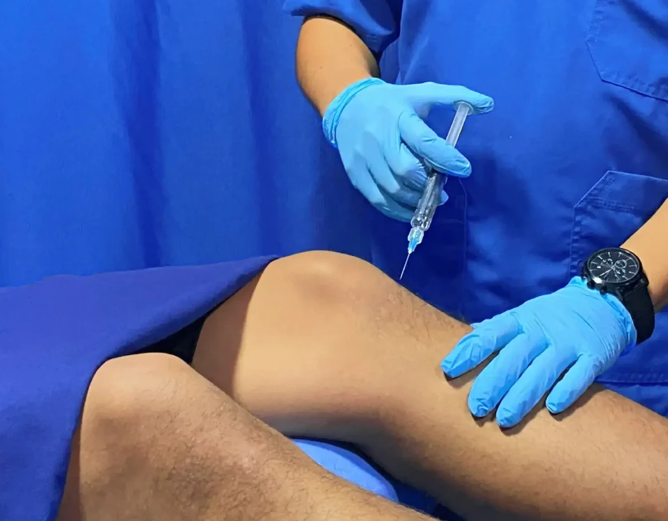 Aplicación de ácido hialurónico en Santa María Fisiomedic como parte del servicio de medicina regenerativa para reducir el dolor articular.