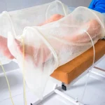 Curación de Heridas en SJL