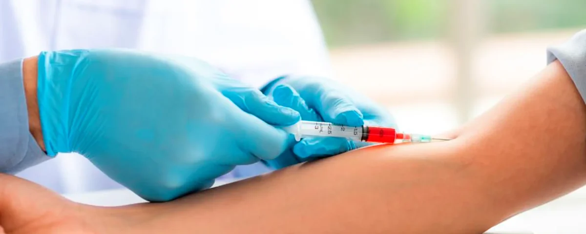 Autohemoterapia Menor en SJL