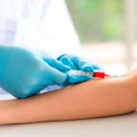 Autohemoterapia Menor en SJL