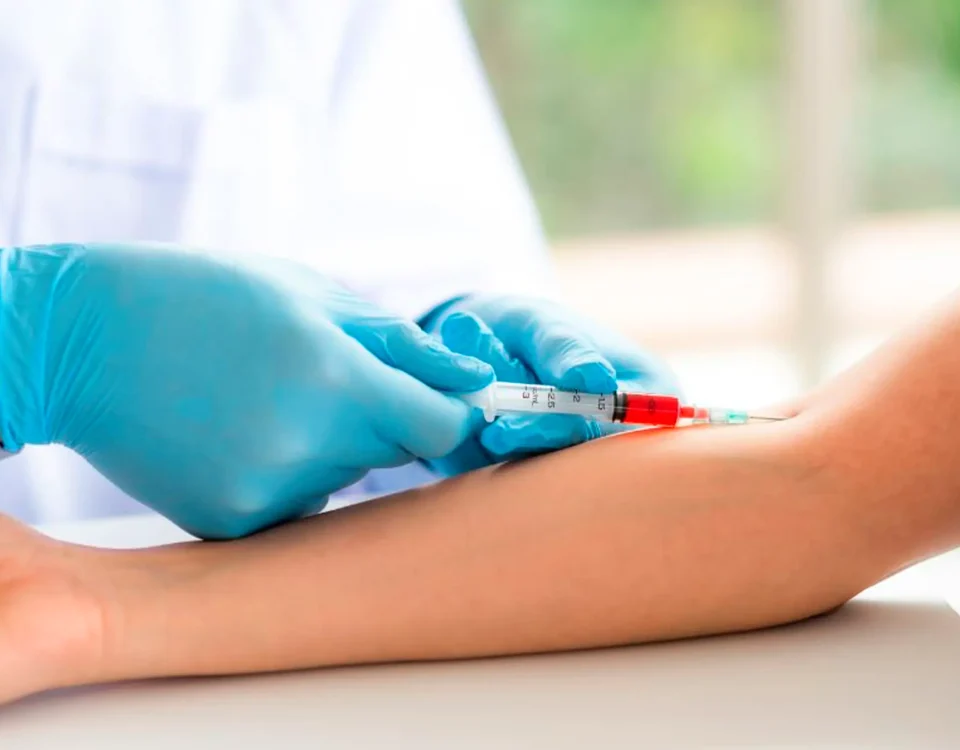Autohemoterapia Menor en SJL