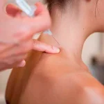 Tratamiento de medicina regenerativa con terapia neural para mejorar la calidad de vida y estimular la regulación natural del organismo.