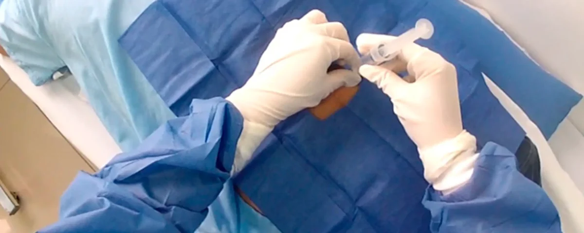 Ozonoterapia médica - Infiltración Rectal en SJL