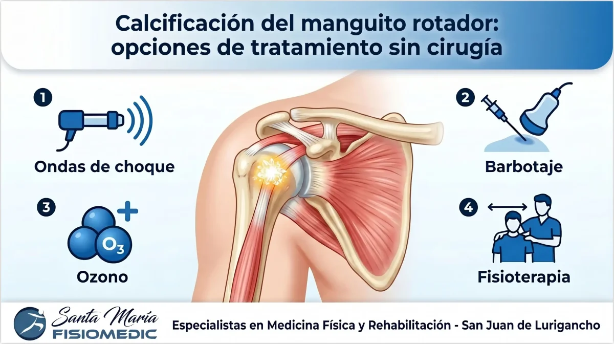 Calcificación del manguito rotador: opciones de tratamiento sin cirugía