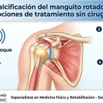 Calcificación del manguito rotador: opciones de tratamiento sin cirugía