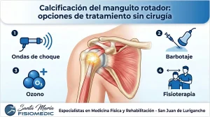Calcificación del manguito rotador: opciones de tratamiento sin cirugía
