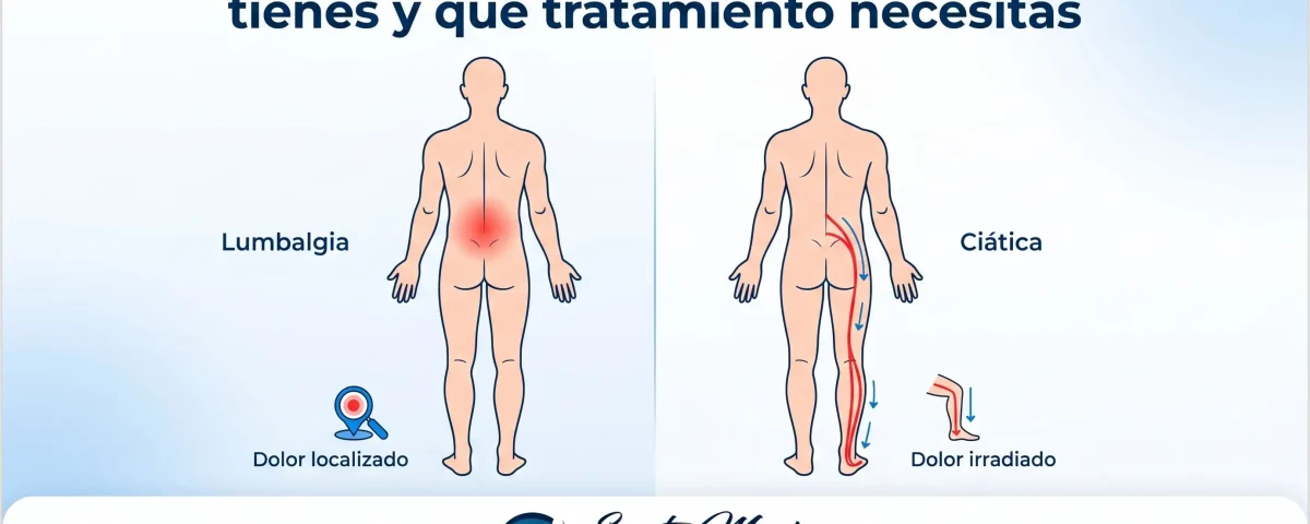 Ciática vs lumbalgia: cómo saber cuál tienes y qué tratamiento necesitas