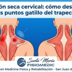 Punción seca cervical: cómo desactiva los puntos gatillo del trapecio
