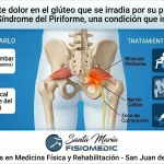 Síndrome del piriforme: el dolor de cadera que se confunde con ciática