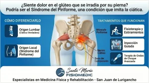 Síndrome del piriforme: el dolor de cadera que se confunde con ciática