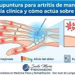 Acupuntura para artritis de manos: evidencia clínica y cómo actúa sobre el dolor