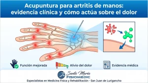 Acupuntura para artritis de manos: evidencia clínica y cómo actúa sobre el dolor