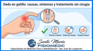 Dedo en gatillo: causas, síntomas y tratamiento sin cirugía
