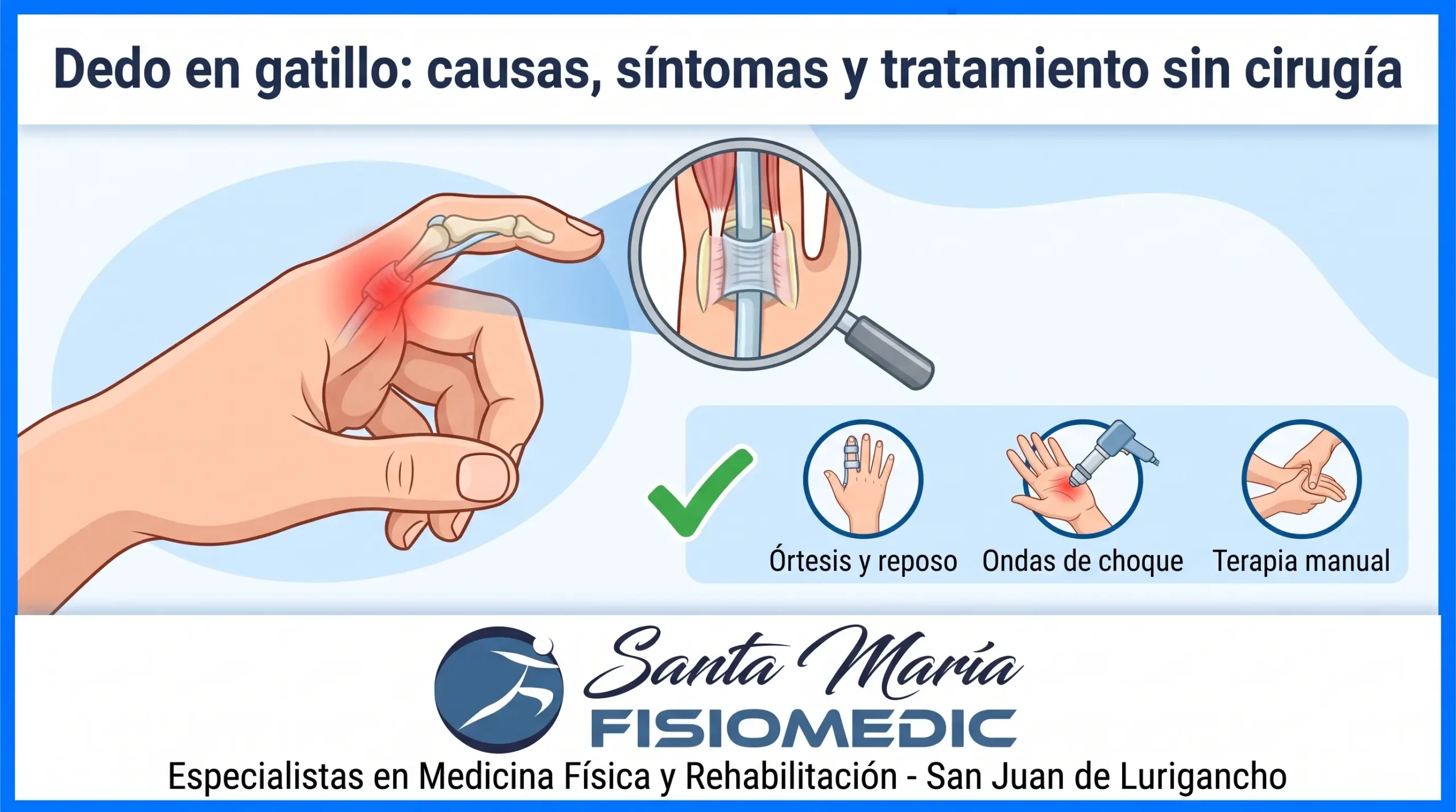 Dedo en gatillo: causas, síntomas y tratamiento sin cirugía