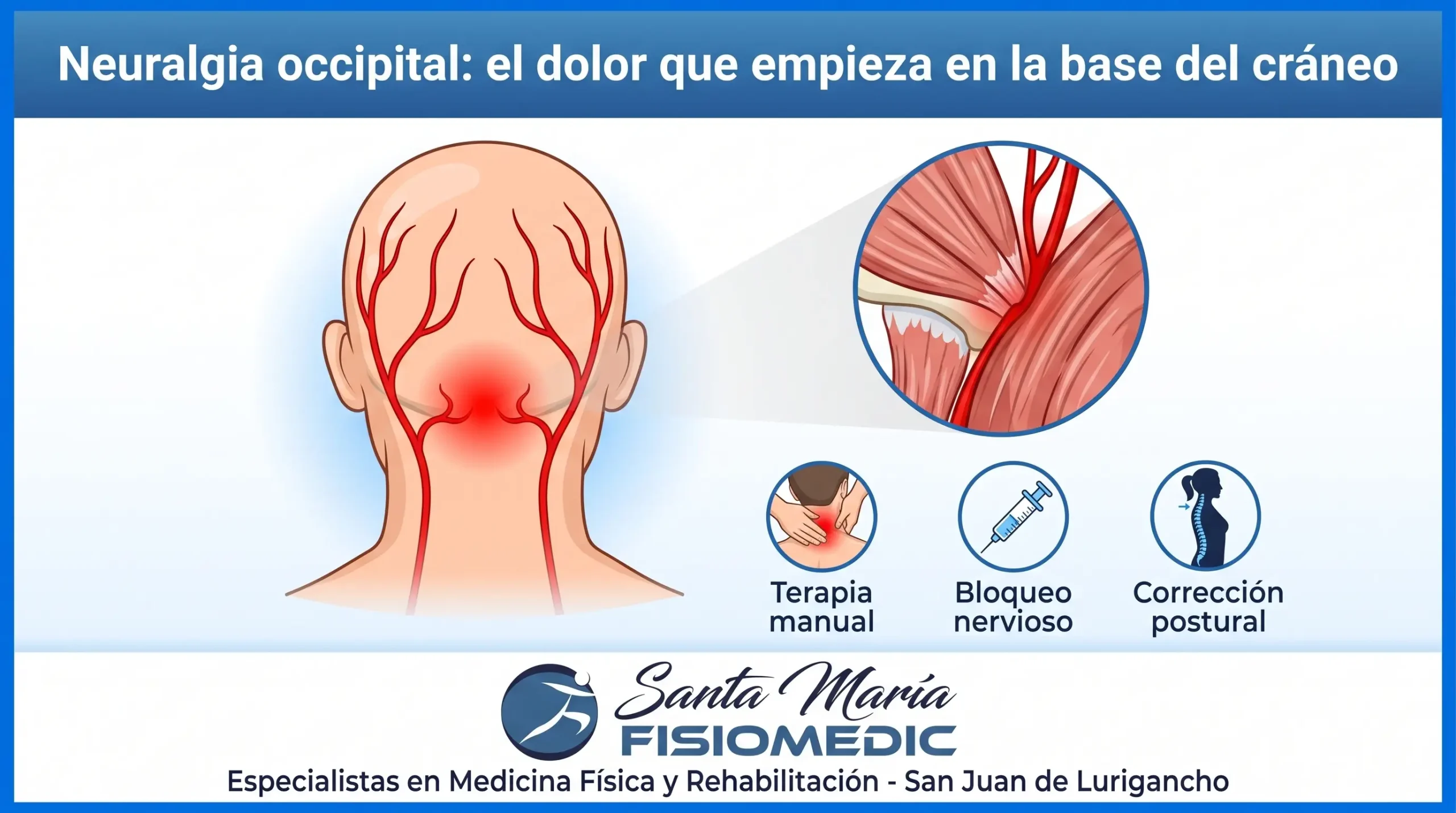 Neuralgia occipital: el dolor que empieza en la base del cráneo