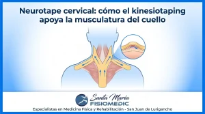 Neurotape cervical: cómo el kinesiotaping apoya la musculatura del cuello