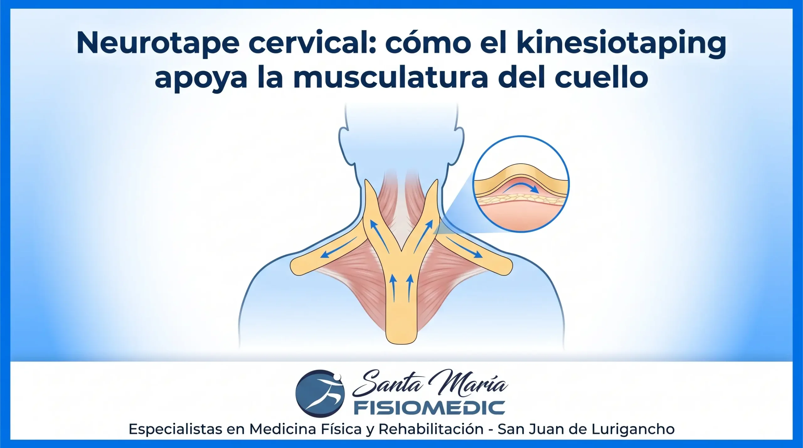 Neurotape cervical: cómo el kinesiotaping apoya la musculatura del cuello