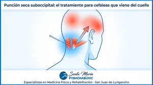 Punción seca suboccipital: el tratamiento para cefaleas que viene del cuello