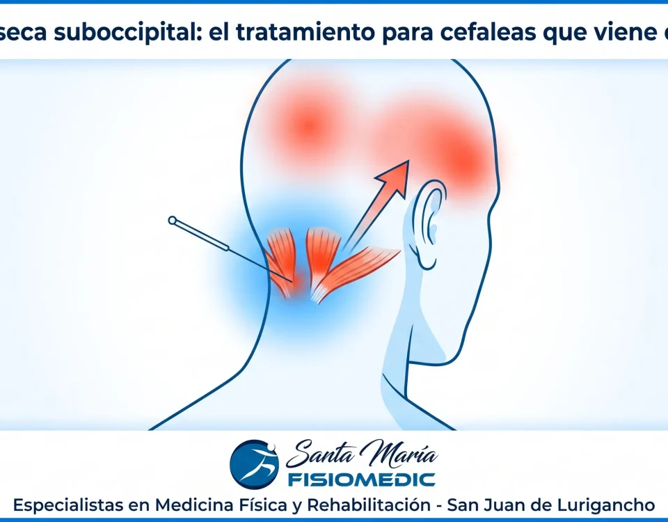 Punción seca suboccipital: el tratamiento para cefaleas que viene del cuello