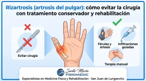 Rizartrosis (artrosis del pulgar): cómo evitar la cirugía con tratamiento conservador y rehabilitación