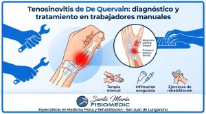 Tenosinovitis de De Quervain: diagnóstico y tratamiento en trabajadores manuales