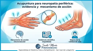Acupuntura para neuropatía periférica: evidencia y mecanismo de acción