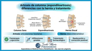 Artrosis de columna (espondiloartrosis): diferencias con la hernia y tratamiento