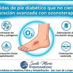Heridas de pie diabético que no cierran: curación avanzada con ozonoterapia