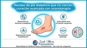 Heridas de pie diabético que no cierran: curación avanzada con ozonoterapia