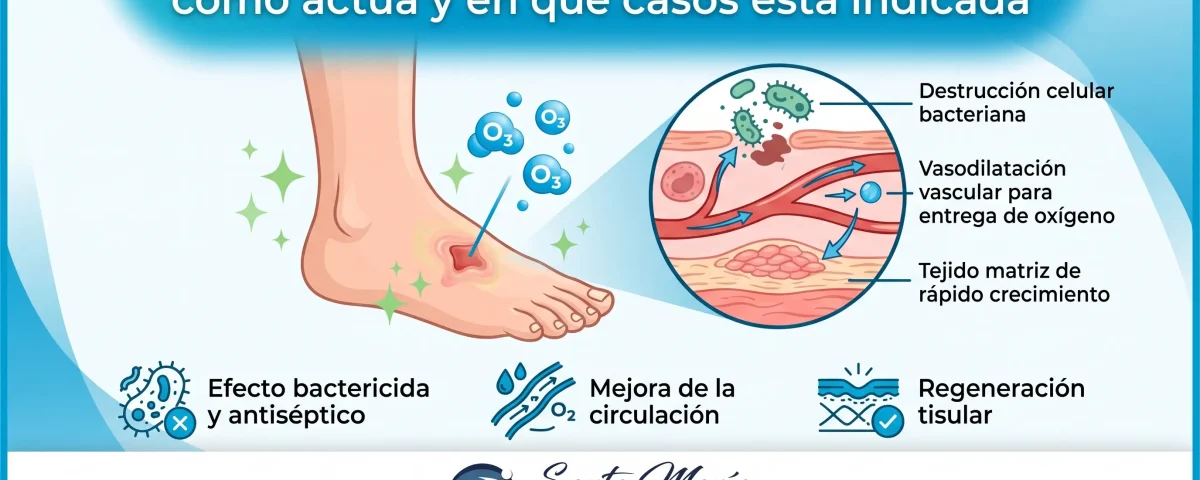 Ozonoterapia para pie diabético: cómo actúa y en qué casos está indicada