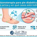 Ozonoterapia para pie diabético: cómo actúa y en qué casos está indicada