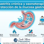 Gastritis crónica y ozonoterapia: protección de la mucosa gástrica