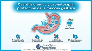 Gastritis crónica y ozonoterapia: protección de la mucosa gástrica