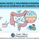 Ozono rectal y microbiota intestinal: su papel en el síndrome de intestino irritable
