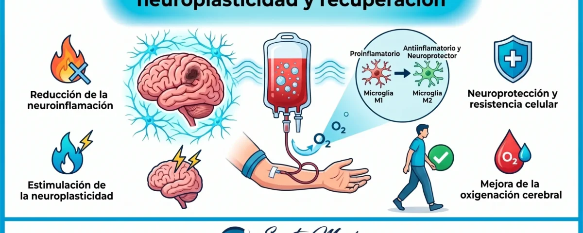 Ozonoterapia sistémica post-ACV: neuroplasticidad y recuperación
