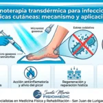 Ozonoterapia transdérmica para infecciones fúngicas cutáneas: mecanismo y aplicaciones