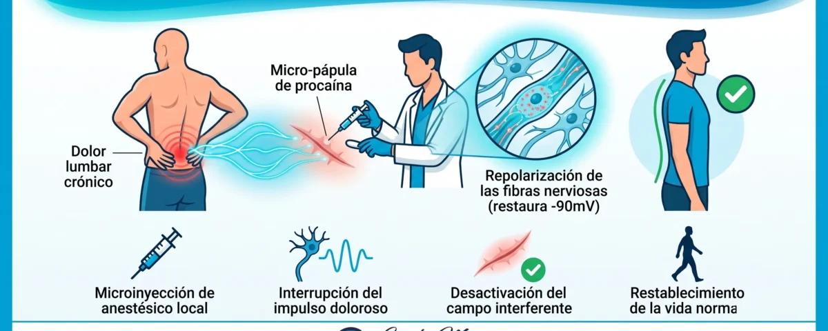 Terapia neural para dolor crónico: cómo funciona y qué esperar