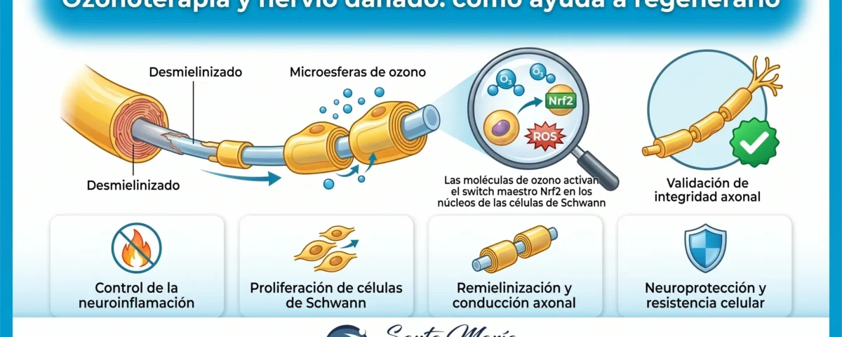 Ozonoterapia y nervio dañado: cómo ayuda a regenerarlo