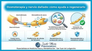 Ozonoterapia y nervio dañado: cómo ayuda a regenerarlo